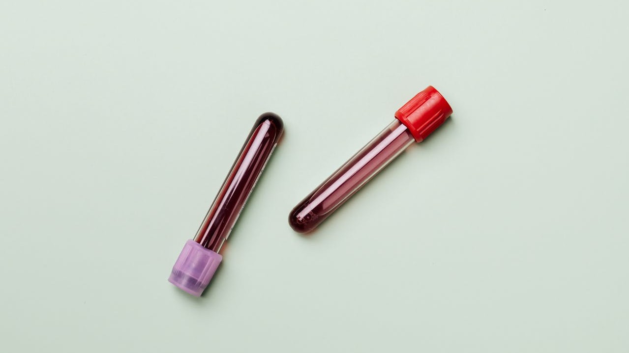 A neutral glass of water and a notepad beside a pen on a table, symbolizing medical evaluation