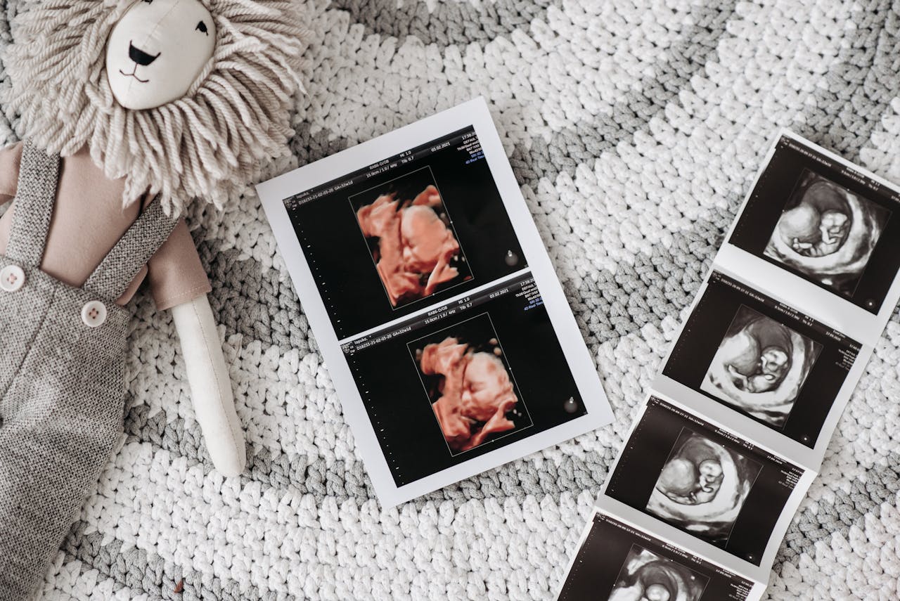 نقل الأجنة في IVF و ICSI: كيف يتم، وما الذي يجب فعله بعده، وما المتوقع واقعياً