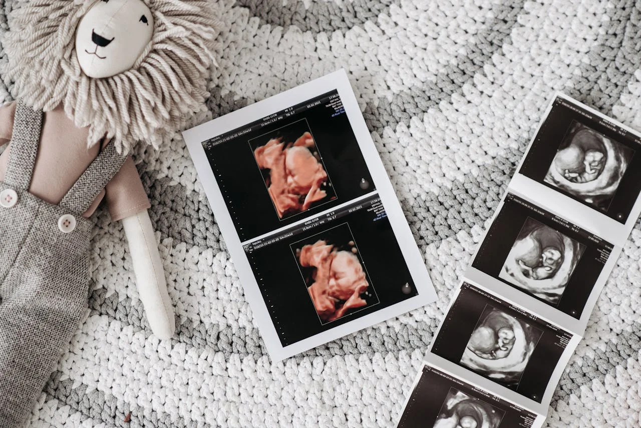 Ein Embryotransfer wird im Kinderwunschzentrum vorbereitet: Katheter und Ultraschallmonitor im Behandlungsraum