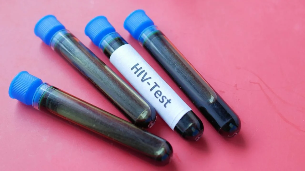 HIV-Schnelltest mit Testkassette, Lanzette und Anleitung auf einem Tisch