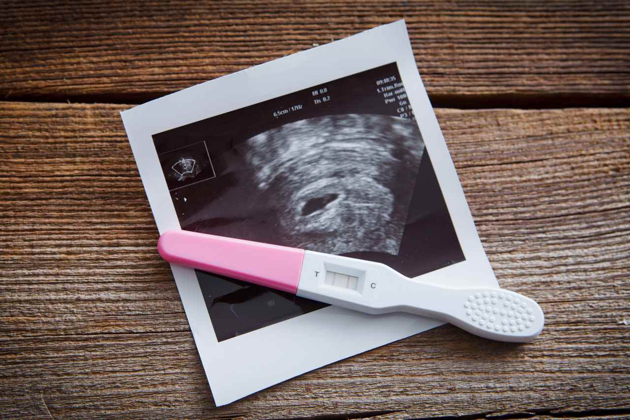 Positive pregnancy test and ultrasound image of a baby