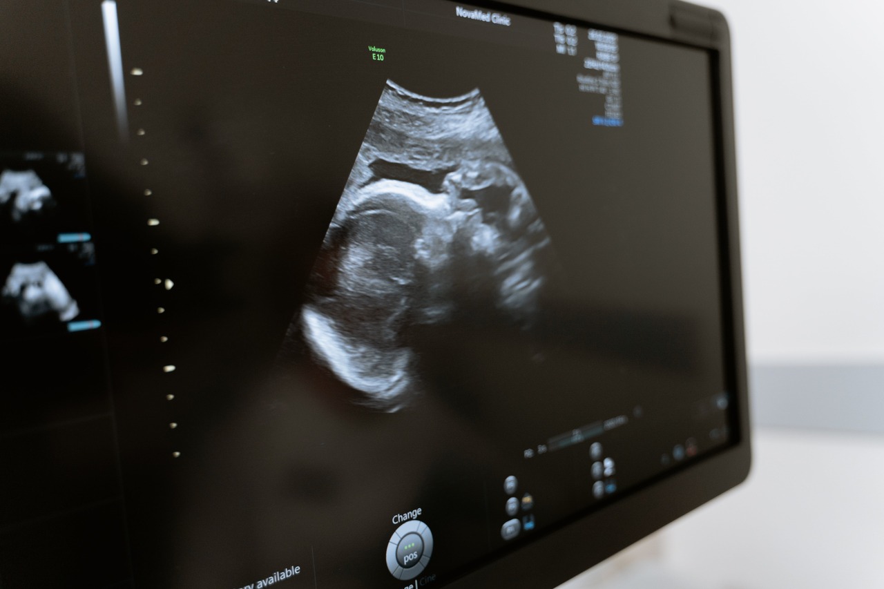 Ultrasound image of an implantation