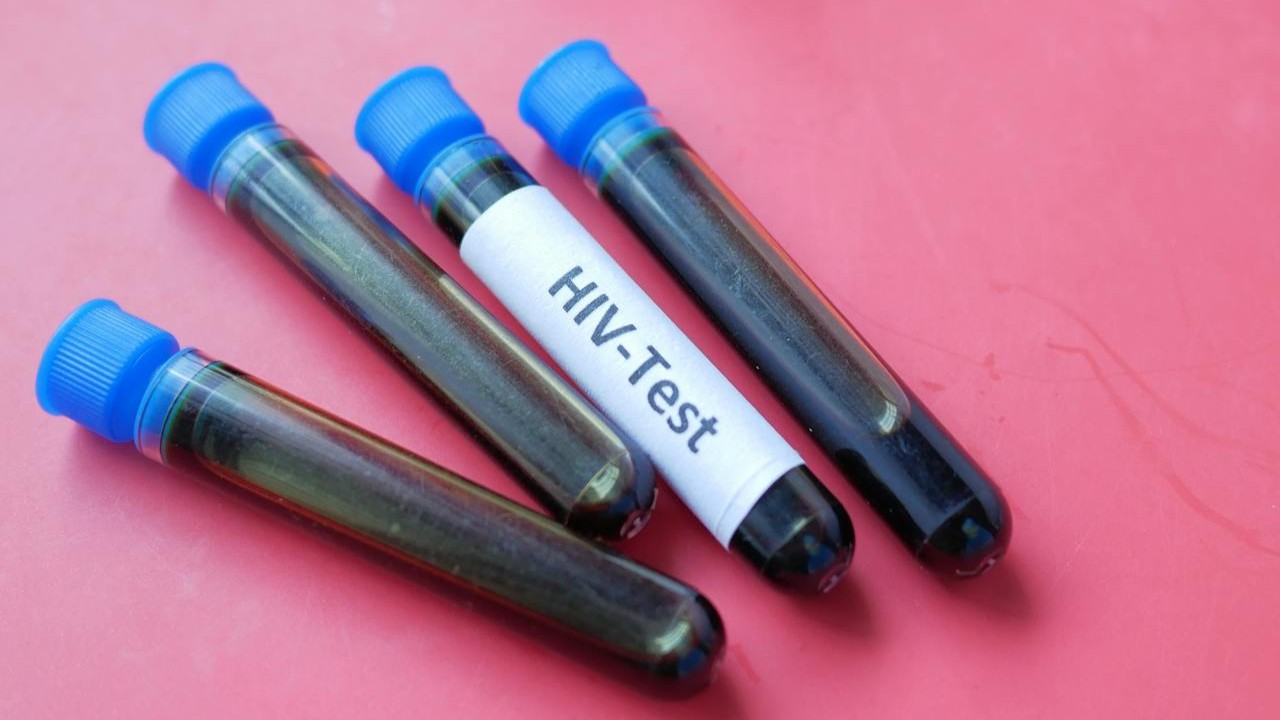 בדיקת HIV מהירה עם קסטה, מחט דקירה והנחיות על שולחן