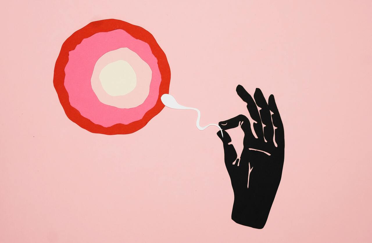 실험실에서의 ICSI: 매우 가는 마이크로 피펫으로 단일 정자를 난자의 세포질에 직접 주입하는 장면