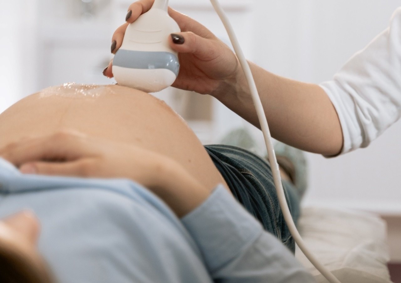 PCOS şüphesiyle yapılan ultrason muayenesi